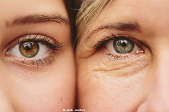 SKIN AGING: what happens in every age