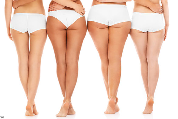 What causes cellulite?